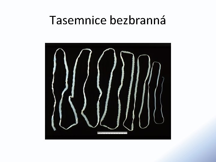 Tasemnice bezbranná 