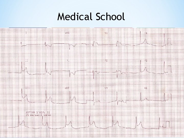 Medical School Year 1 Year 2 Lectures • Anatomy • Molecular Biology • Immunology