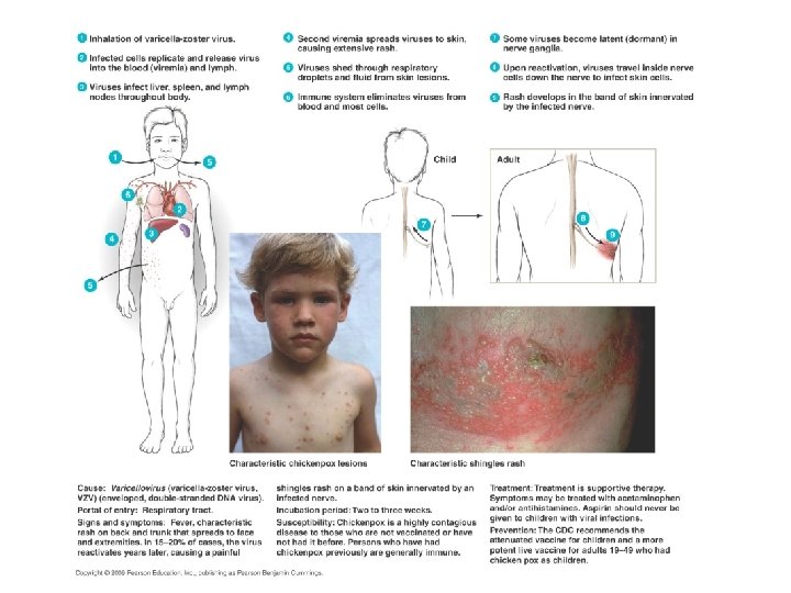 [INSERT DISEASE AT A GLANCE 19. 7] 