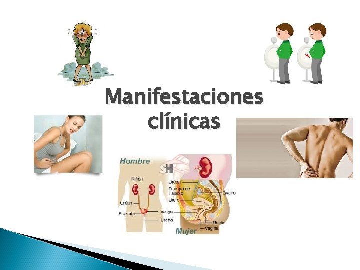 Manifestaciones clínicas 