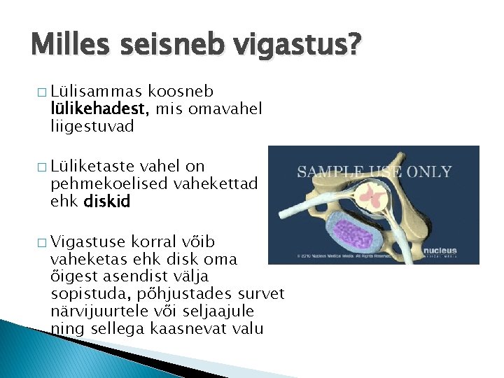 Milles seisneb vigastus? � Lülisammas koosneb lülikehadest, mis omavahel liigestuvad � Lüliketaste vahel on