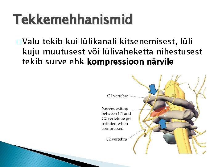Tekkemehhanismid � Valu tekib kui lülikanali kitsenemisest, lüli kuju muutusest või lülivaheketta nihestusest tekib