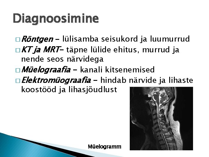 Diagnoosimine � Röntgen - lülisamba seisukord ja luumurrud � KT ja MRT- täpne lülide