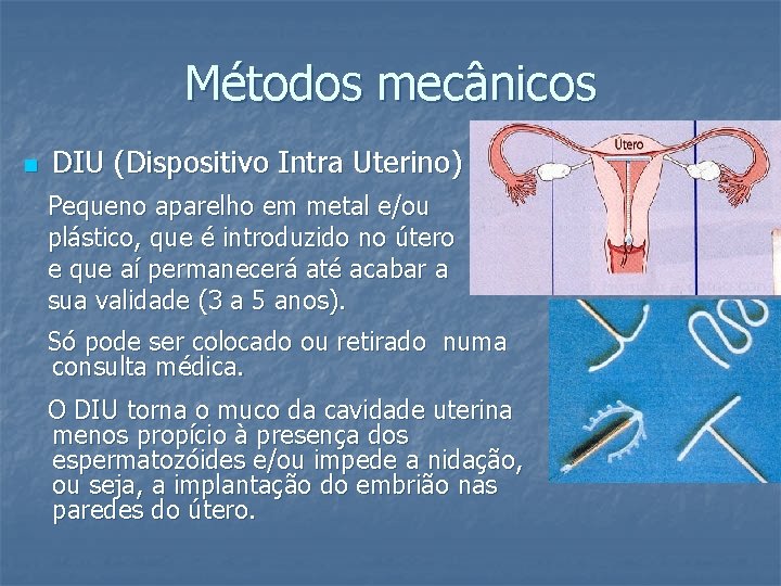 Métodos mecânicos n DIU (Dispositivo Intra Uterino) Pequeno aparelho em metal e/ou plástico, que