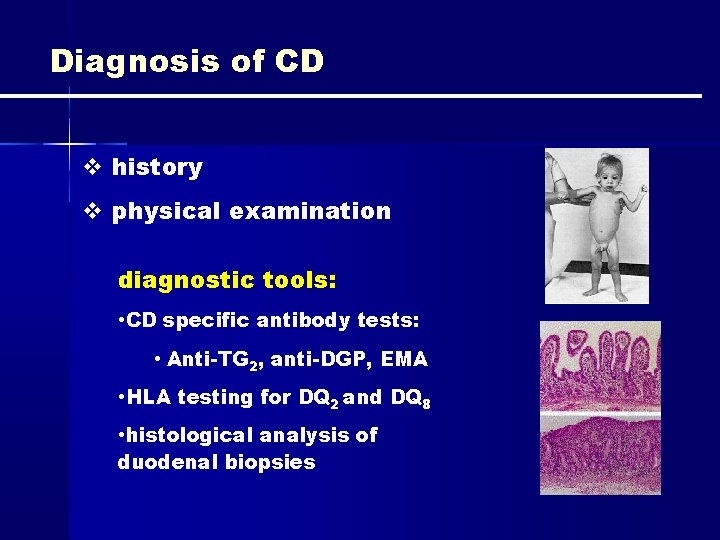 Diagnosis of CD history physical examination diagnostic tools: • CD specific antibody tests: •