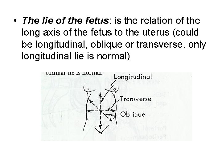  • The lie of the fetus: is the relation of the long axis