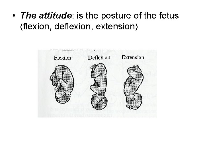  • The attitude: is the posture of the fetus (flexion, deflexion, extension) 