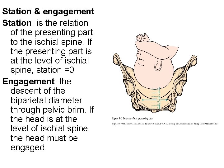 Station & engagement Station: is the relation of the presenting part to the ischial