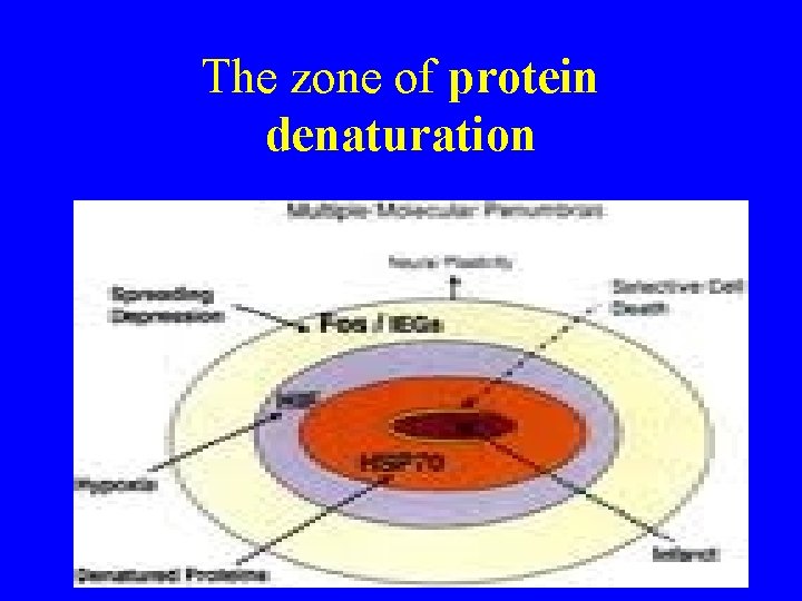 The zone of protein denaturation 