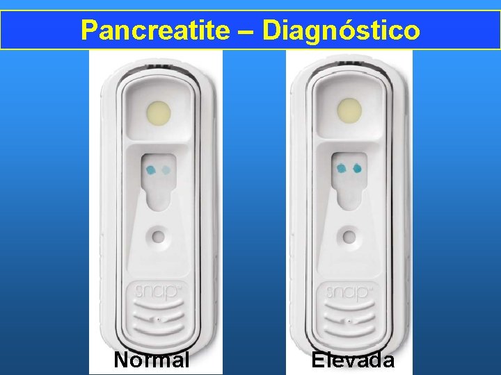 Pancreatite – Diagnóstico Normal Elevada 