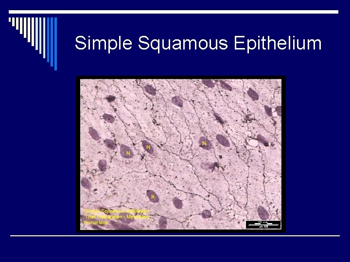 Simple Squamous Epithelium 