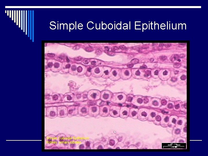 Simple Cuboidal Epithelium 