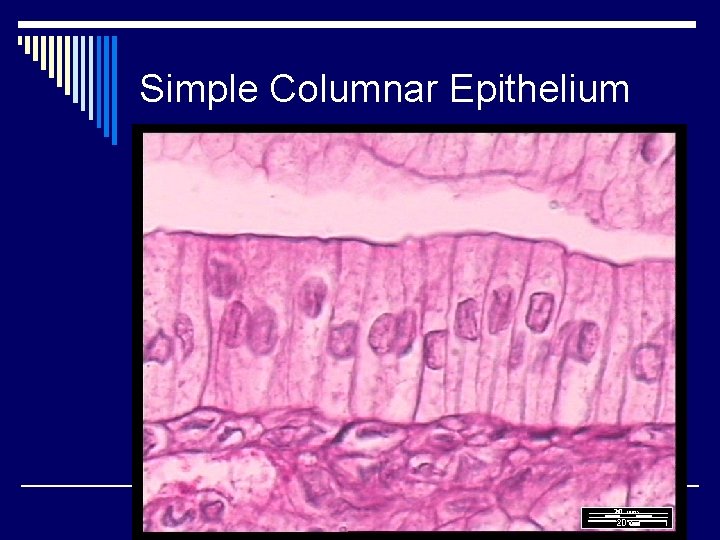 Simple Columnar Epithelium 