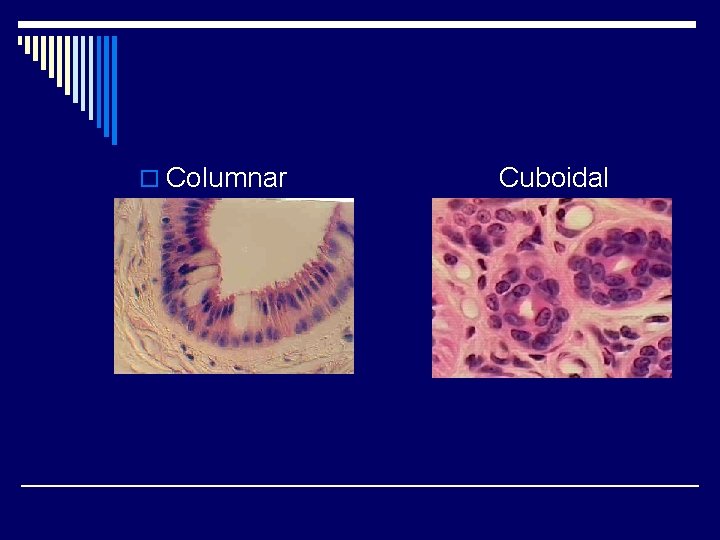 o Columnar Cuboidal 