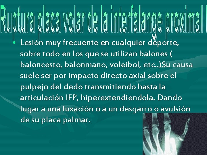 • Lesión muy frecuente en cualquier deporte, sobre todo en los que se • Lesión muy frecuente en cualquier deporte, sobre todo en los que se