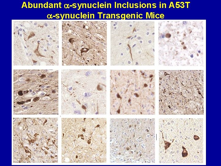 Abundant -synuclein Inclusions in A 53 T -synuclein Transgenic Mice SNL-4 Spinal cord Syn