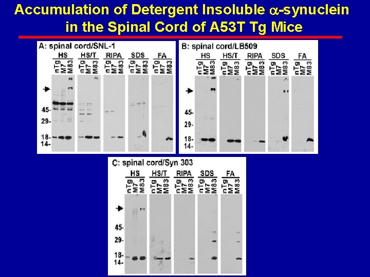 Accumulation of Detergent Insoluble -synuclein in the Spinal Cord of A 53 T Tg