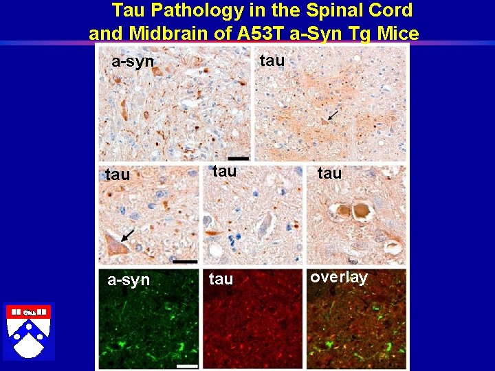 Tau Pathology in the Spinal Cord and Midbrain of A 53 T a-Syn Tg