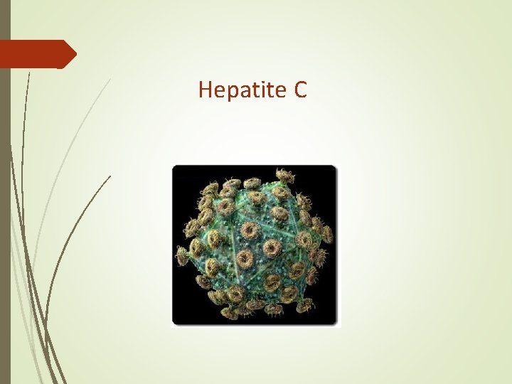Hepatite C Hepatite C