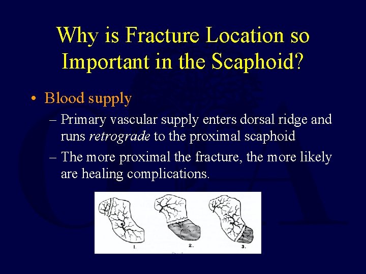 Why is Fracture Location so Important in the Scaphoid? • Blood supply – Primary