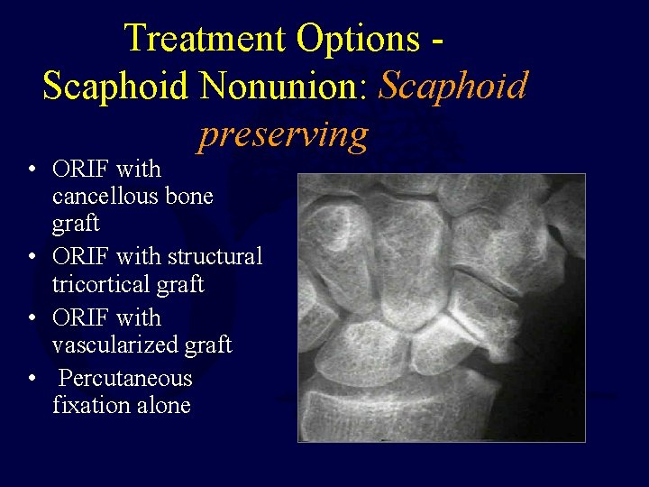 Treatment Options Scaphoid Nonunion: Scaphoid preserving • ORIF with cancellous bone graft • ORIF