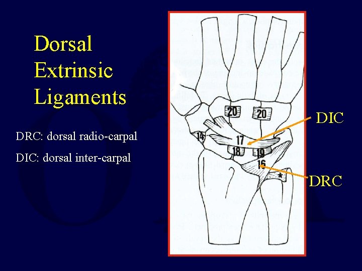 Dorsal Extrinsic Ligaments DIC DRC: dorsal radio-carpal DIC: dorsal inter-carpal DRC 