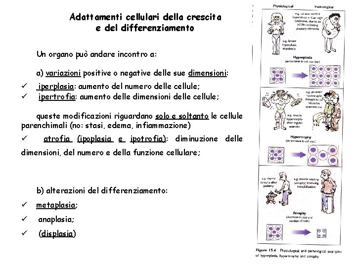 Adattamenti cellulari della crescita e del differenziamento Un organo può andare incontro a: a)