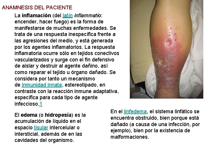 ANAMNESIS DEL PACIENTE La inflamación (del latín inflammatio: encender, hacer fuego) es la forma