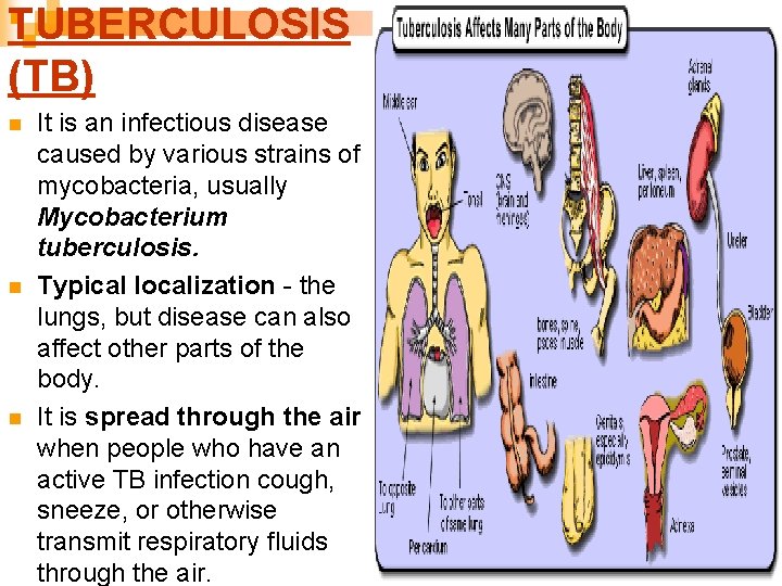 TUBERCULOSIS (TB) n n n It is an infectious disease caused by various strains