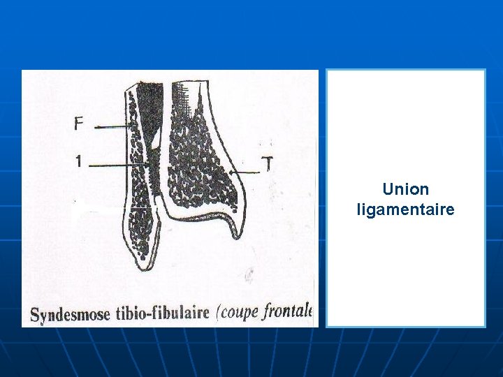 Union ligamentaire 