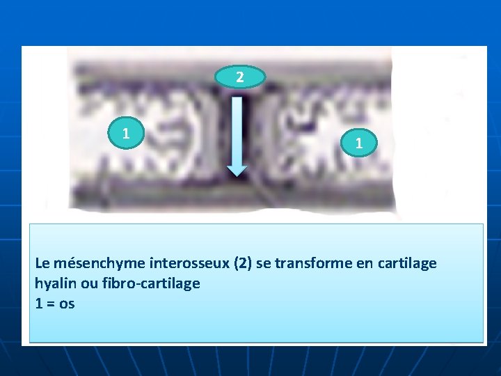 2 1 1 Le mésenchyme interosseux (2) se transforme en cartilage hyalin ou fibro-cartilage