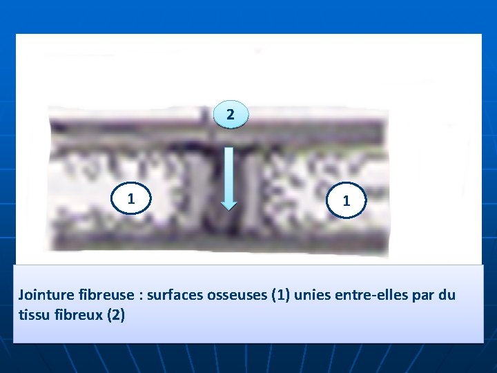 2 1 1 Jointure fibreuse : surfaces osseuses (1) unies entre-elles par du tissu