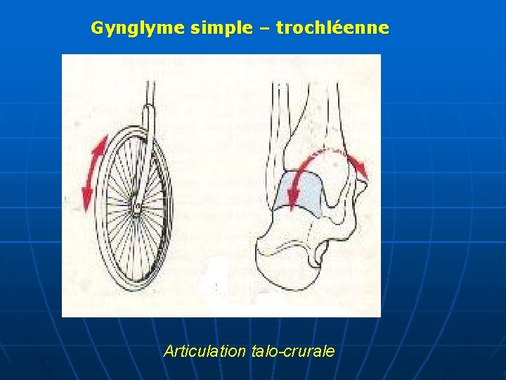 Gynglyme simple – trochléenne Articulation talo-crurale 
