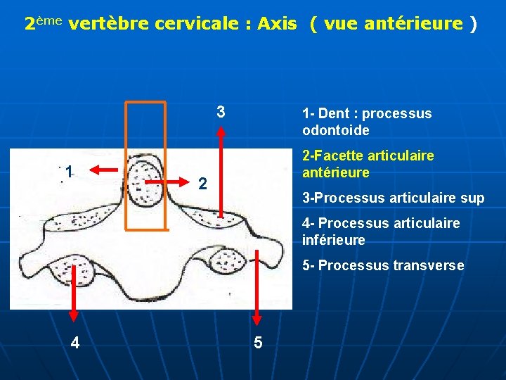 2ème vertèbre cervicale : Axis ( vue antérieure ) 3 1 1 - Dent