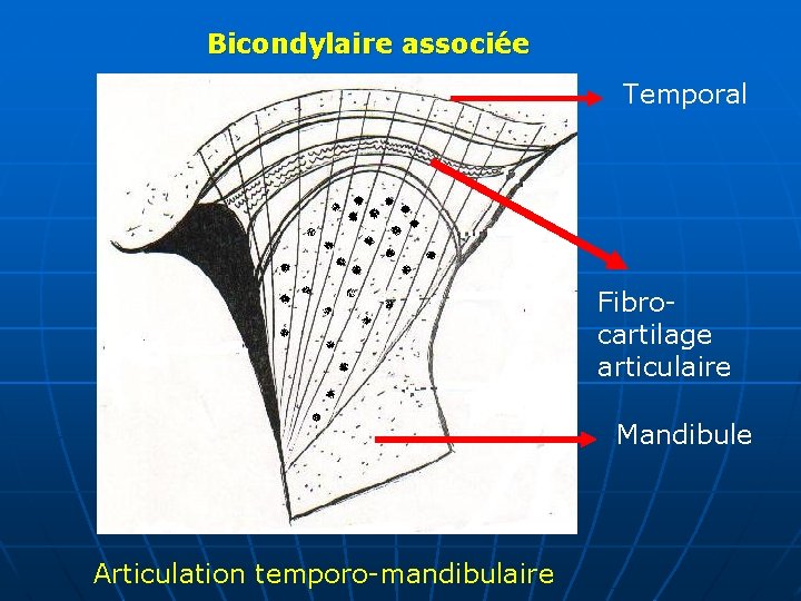 Bicondylaire associée Temporal Fibrocartilage articulaire Mandibule Articulation temporo-mandibulaire 