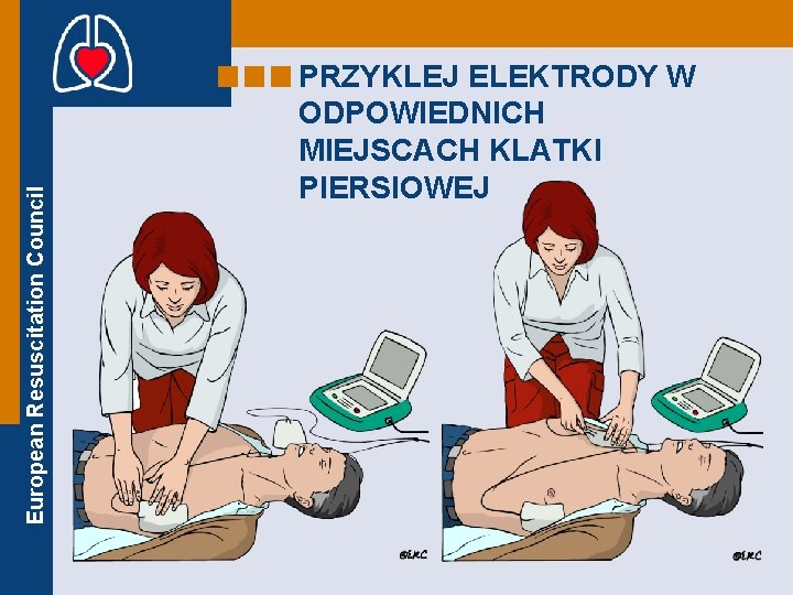 European Resuscitation Council PRZYKLEJ ELEKTRODY W ODPOWIEDNICH MIEJSCACH KLATKI PIERSIOWEJ 