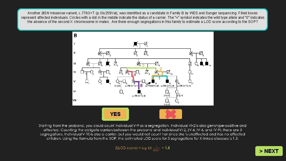 Bgn Xlinked Spondyloepimetaphyseal Dysplasia Pmid Start Bgn