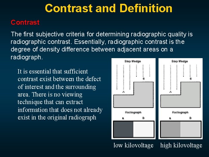 Contrast and Definition Contrast The first subjective criteria for determining radiographic quality is radiographic