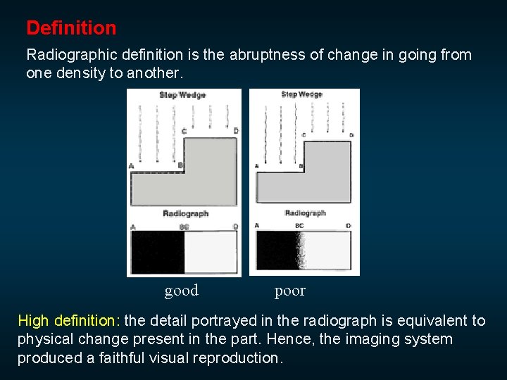 Definition Radiographic definition is the abruptness of change in going from one density to