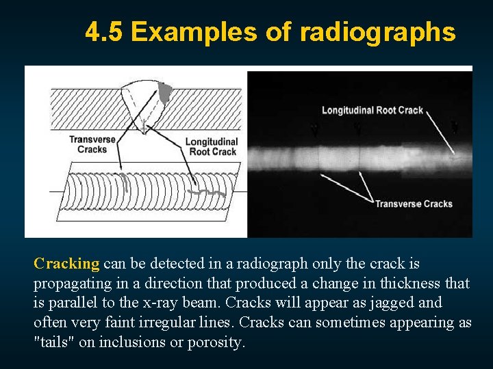 4. 5 Examples of radiographs Cracking can be detected in a radiograph only the