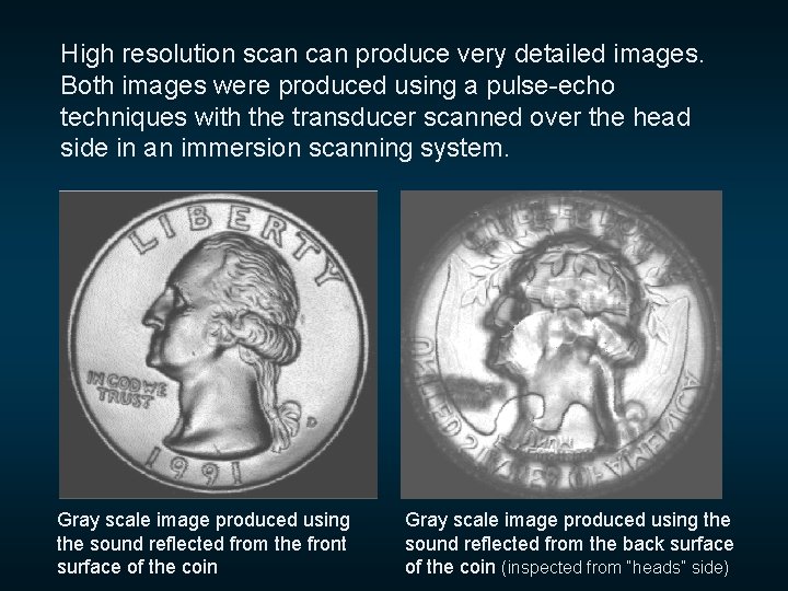 High resolution scan produce very detailed images. Both images were produced using a pulse-echo