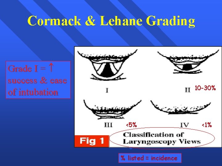 Cormack & Lehane Grading Grade I = success & ease of intubation 10 -30%