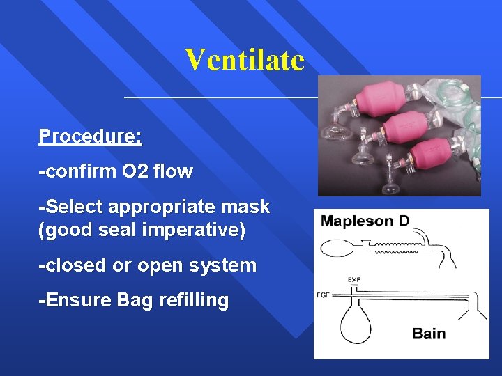 Ventilate Procedure: -confirm O 2 flow -Select appropriate mask (good seal imperative) -closed or