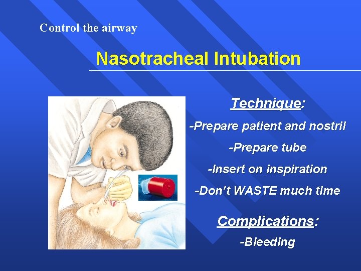 Control the airway Nasotracheal Intubation Technique: -Prepare patient and nostril -Prepare tube -Insert on