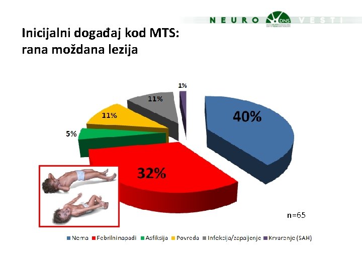 Inicijalni događaj kod MTS: rana moždana lezija n=65 