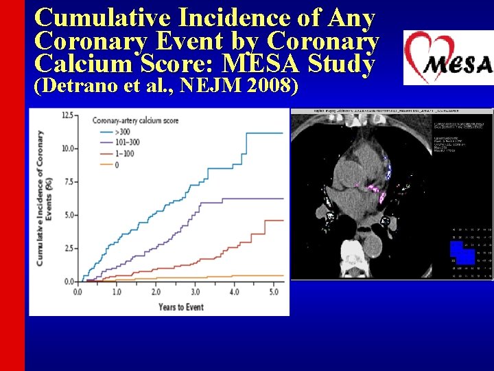 Cumulative Incidence of Any Coronary Event by Coronary Calcium Score: MESA Study (Detrano et