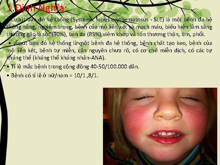 1. Định Nghĩa: • Lupút ban đỏ hệ thống (Systemic lupus erythematosus - SLE)