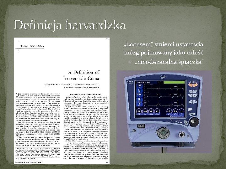 Definicja harvardzka „Locusem” śmierci ustanawia mózg pojmowany jako całość = „nieodwracalna śpiączka” 