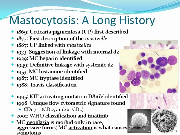 Mastocytosis: A Long History 1869: Urticaria pigmentosa (UP) first described 1877: First description of