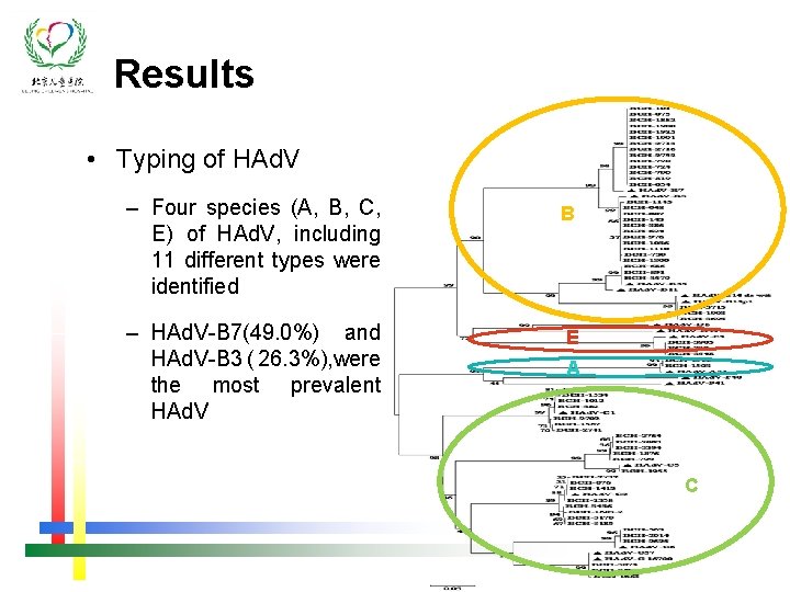 Results • Typing of HAd. V – Four species (A, B, C, E) of